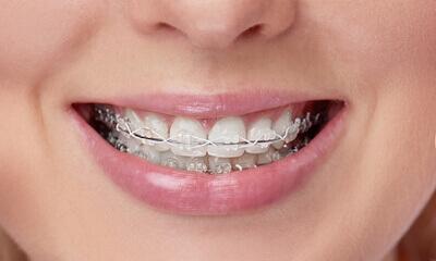 Why settle for less when you can have the perfect smile?