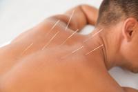 Acupuncture: The Incredible Impact on Your Health