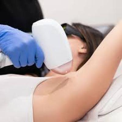 Permanent Hair Reduction Pleasanton