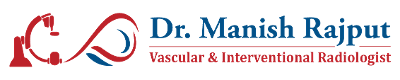 Dr Manish Rajput Varicose Veins