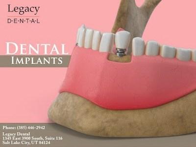 Dentist Service Available at Legacy Dental in Salt Lake City, UT