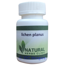 Natural Herbal Remedies For Lichen Planus