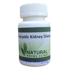 Herbal Remedies For Polycystic Kidney Disease