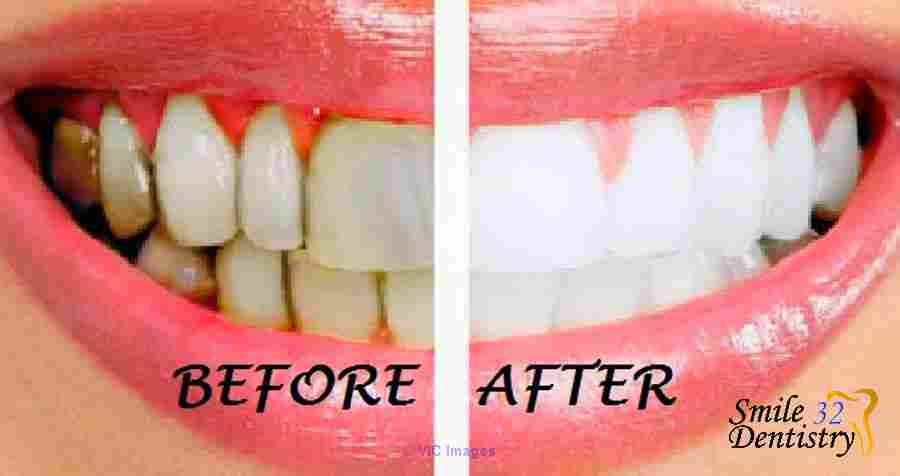 Dentist Calgary SW