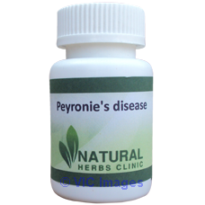 Natural Herbal Remedies For Peyronies Disease
