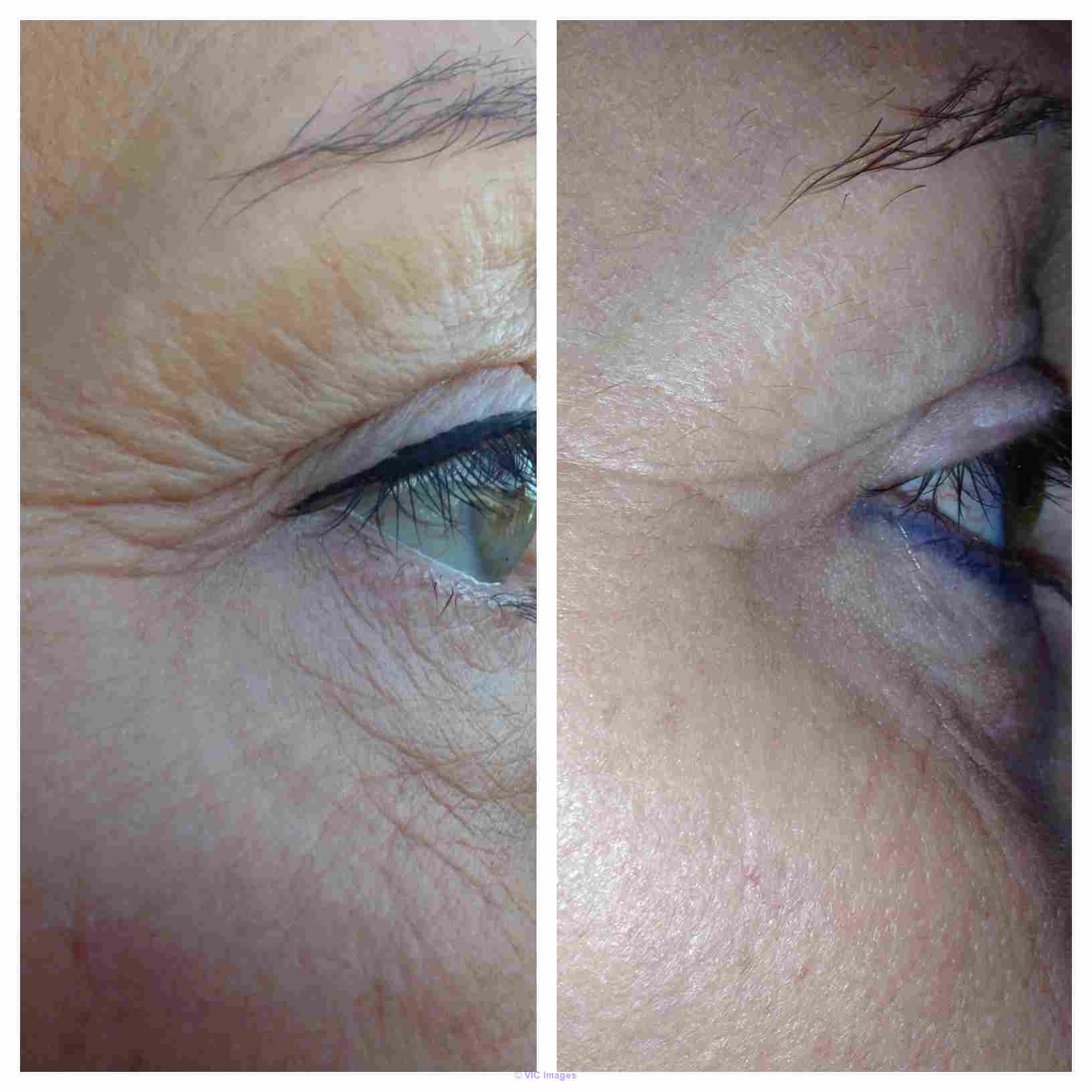 3UR-Free  Nerium Products