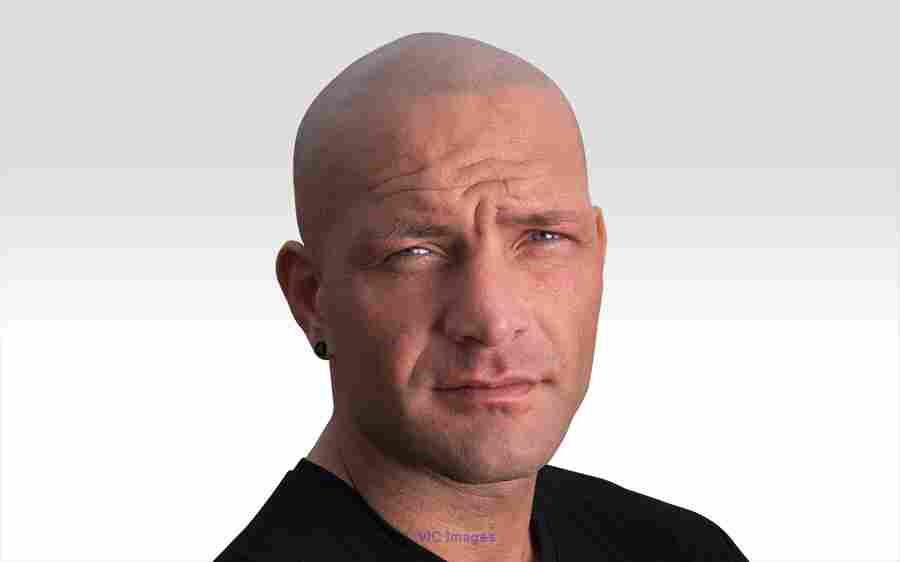 Balding, Thinning Hair or Losing Hair - Best Solution for You.