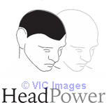 Learn Scalp Micro-pigmentation. SMP Training available