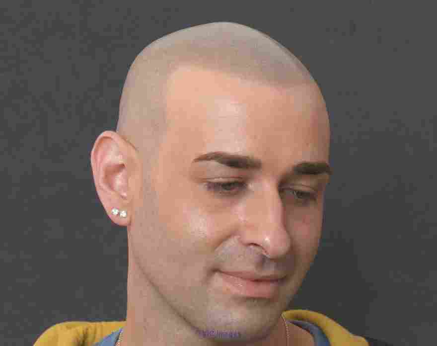 Scalp Micropigmentation Training  Register for HeadPower SMP Certific
