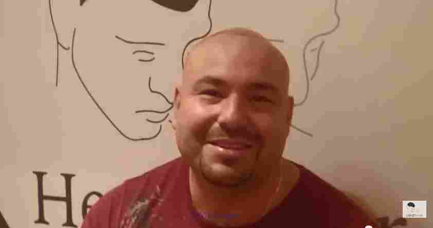 Are you Going Bald? Male Pattern Baldness Solved. Medical Hair.