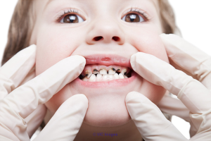 Child Dentist And Kid Dentist Care At OasisDental