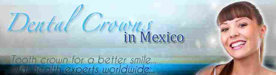Dental Crowns in Tijuana Mexico