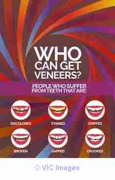 Recommended Porcelain Veneers Toronto