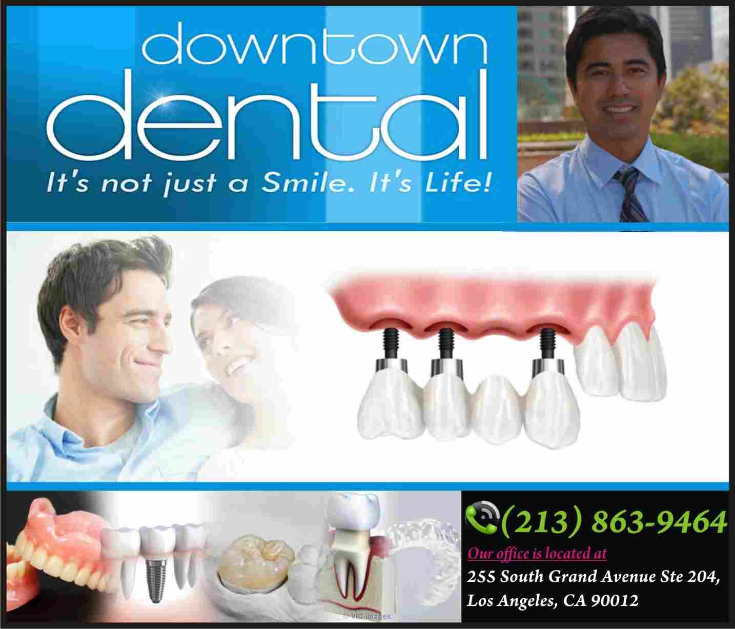 Best Implant Dentist Los Angeles