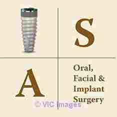 Dental Implants San Diego