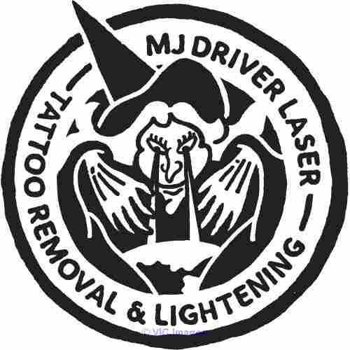 MJ Driver Laser Tattoo Removal & Lightening