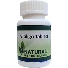 Natural Remedies for Vitiligo