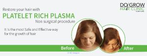 Hair Loss Dermatologist Toronto