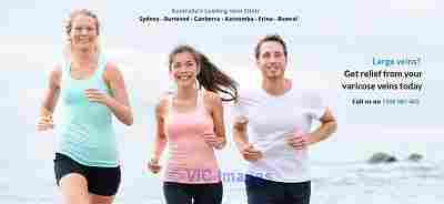 Varicose Vein Treatment
