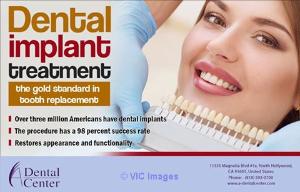 Dental implants North Hollywood
