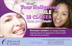 Dental veneers north hollywood ca