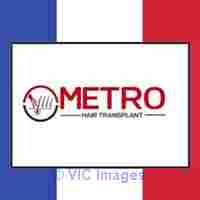 Top and Best Hair Tranplant Clinic in Cannada