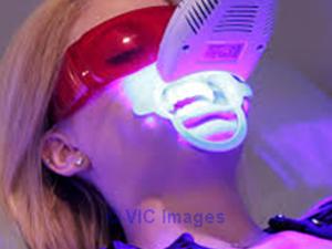 Zoom Teeth Whitening to Brighten Your Teeth