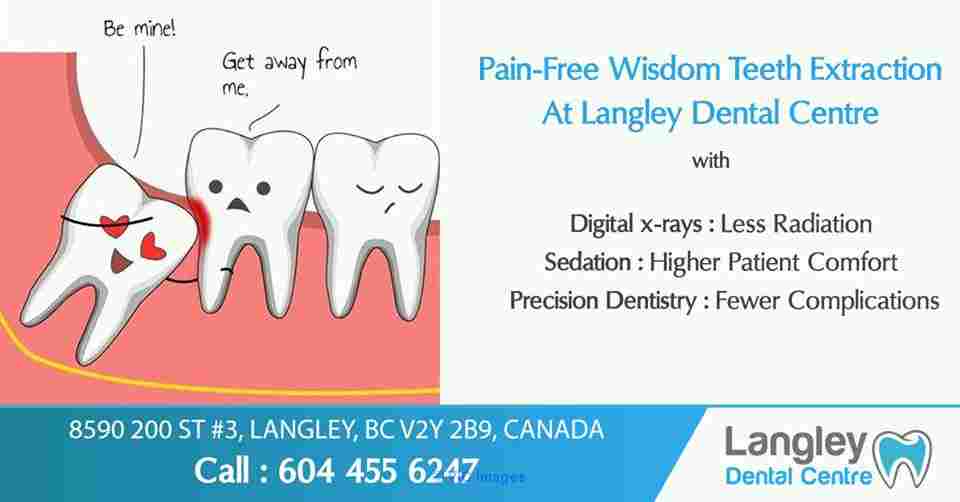 Dentist Langley BC- Wisdom tooth extraction cost - Langley dentist