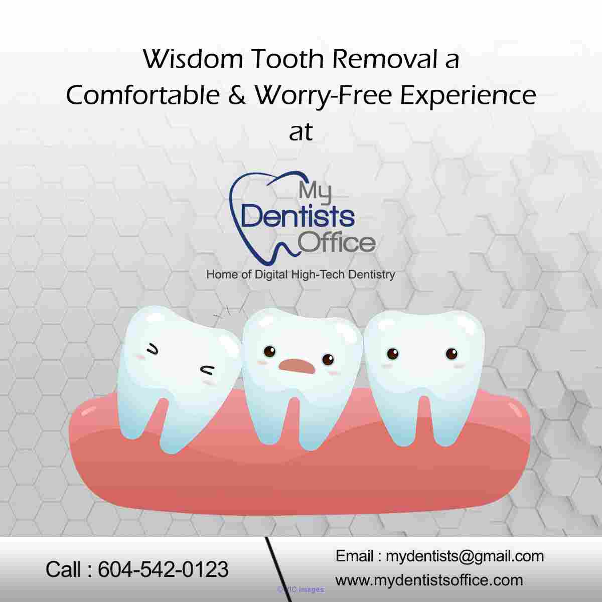 wisdom teeth removal surrey bc - best dentist in surrey