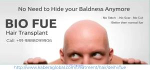 Top FUE hair Transplant Clinic in Delhi