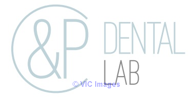 Comfortable night guards Ontario - C&P Dental Lab