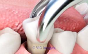 Dentist in College Station | Dental care in College Station