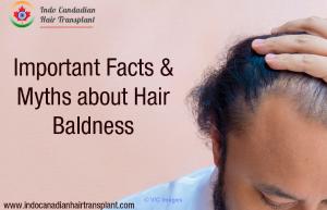 Best hair transplant in chandigarh | Best Hair Transplant in Shimla