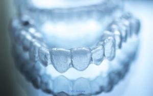 Invisalign Dentist Edmonton
