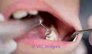 Hire Richmond Emergency Dentist