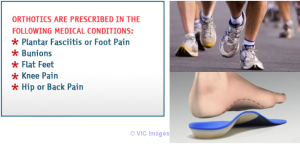 Fix Your Feet with Custom Orthotics in Mississauga!