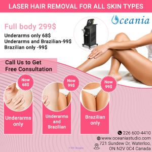 permanent hair removal in Waterloo
