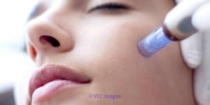 Micro-Needling Service