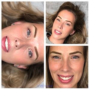 Best Teeth Whitening Solution in Calgary
