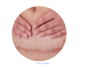 Damaged Skin Repair  Myscartape
