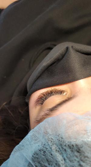 Eyelash extension montreal microneedling