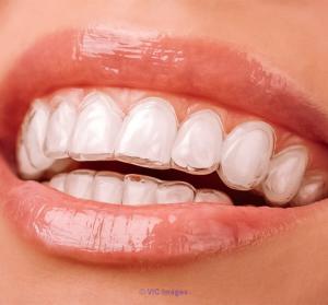 Best Dental Invisalign Clinic in Calgary