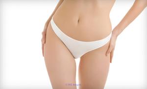Bikini Waxing | Brazilian Waxing | Waxalon - Mississauga