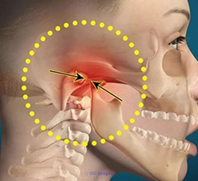 Get Best TMJ Treatment in Calgary from Galaxy Dental