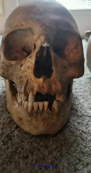 Real Human Bones for sale