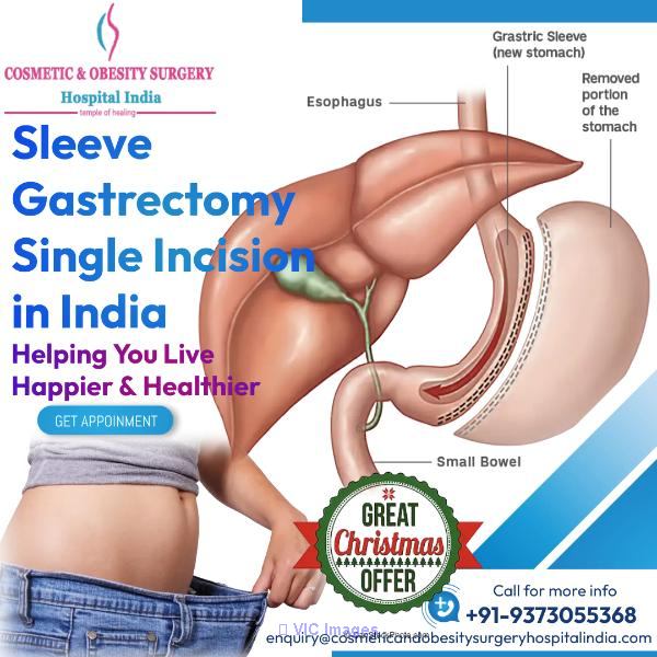 Best Hospitals for Sleeve Gastrectomy Surgery India