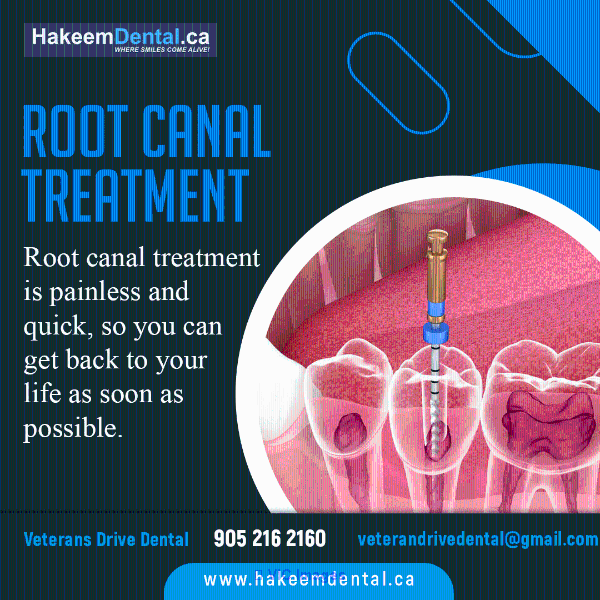 Root Canal Treatment North Brampton