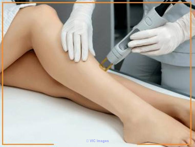 Laser hair removal clinic Edmonton | Best laser clinic in Edmonton