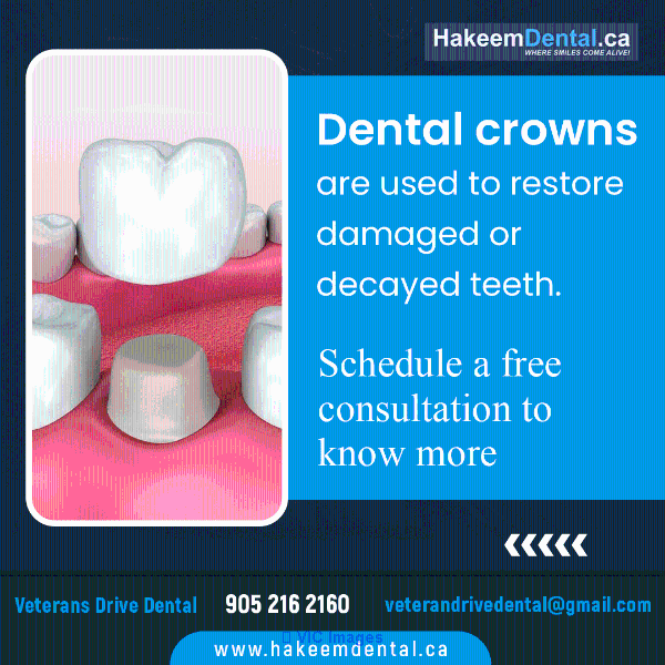 Dental Crowns North Brampton