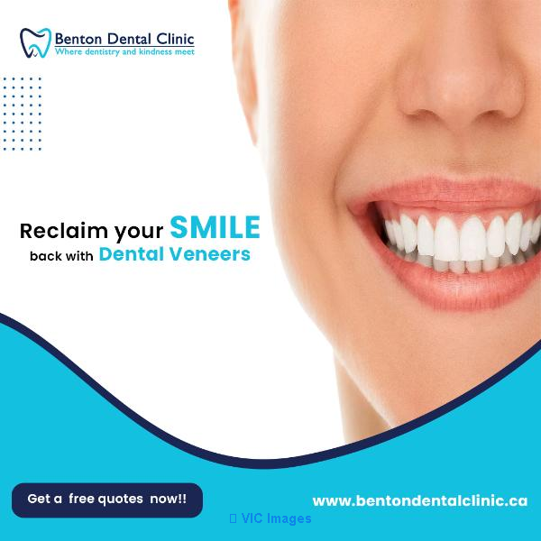 Dental Implants in Kitchener | Dentist in Kitchener